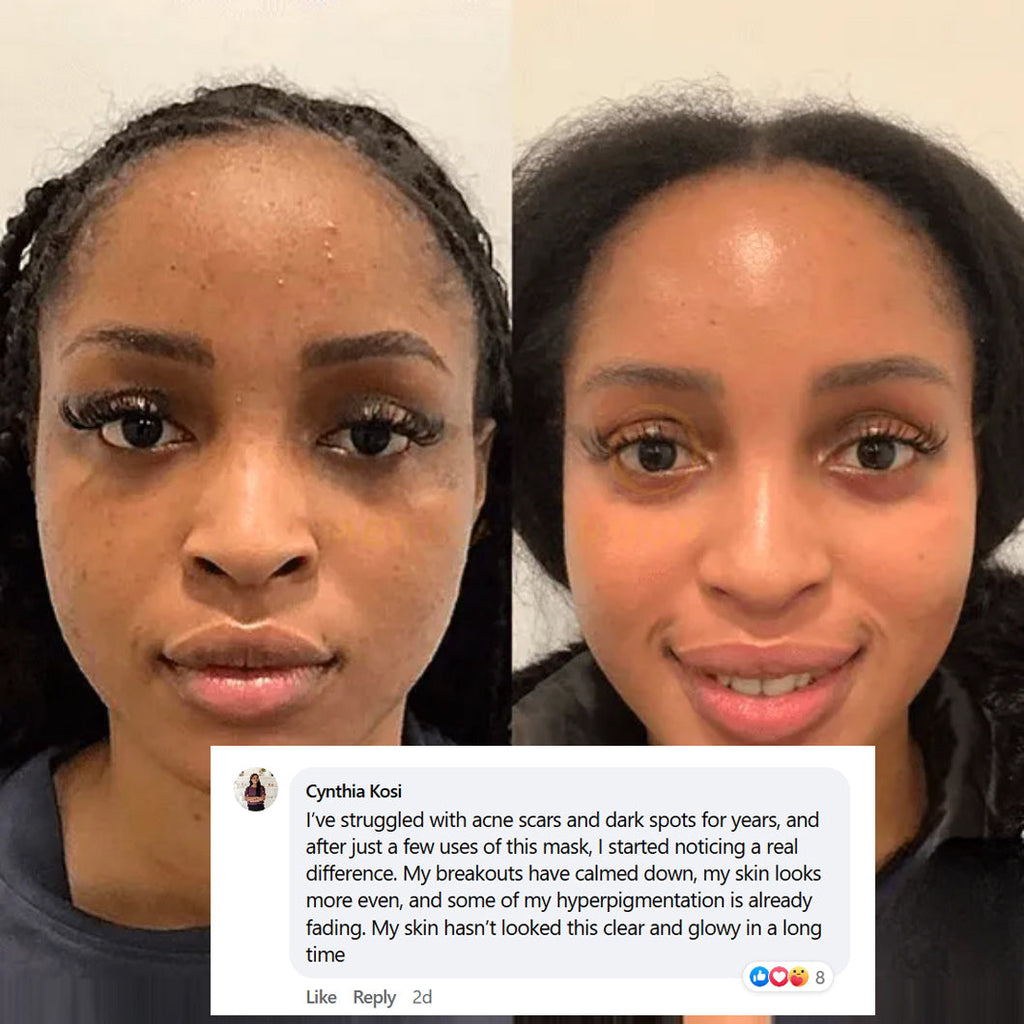 YORUNE Collagen Night Wrapping Masks